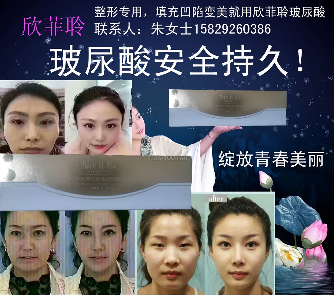 欣菲聆® 玻尿酸